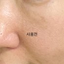 알리아 | 피부가 반짝이는 비밀, 슈알리아 SHC-100 뉴트리션 앰플 사용 후기