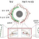 국내 연구진, 녹내장 발병원인 규명… /독사의 자식들.. /지식의 저주.. 문명의 함정.. /의학의 무지 vs 히포크라테스의 진리 vs &#39;도가&#39;의 세가지 법 이미지