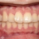 프라임에스치과교정과치과병원 이미지