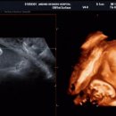 안동성소병원 산후조리원 이미지