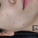 르노삼성자동차김해점 | 김해피부관리 김해왁싱 김해속눈썹 온다뷰티끄 더치필(화이트스피큘)