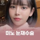 미노성형외과 피부시술 안면거상 잘하는곳