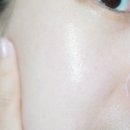 지성온누리약국 | 피코토닝 후 피부장벽 관리법 지피덤 EGF재생크림 후기