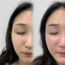천안눈썹문신 99% 성공하는 샵 (+아산눈썹)