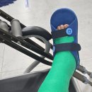 SRC재활병원2 | 발목인대파열 수술후기 +조직괴사 2편 (수술후재활)