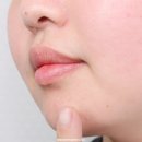 그린CNP | 다이소 기초화장품 브랜드 CNP 스팟카밍젤 후기 (인기 추천템인데 과연?)