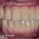 이다운치과기공소 이미지