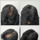 블랙샌드뷰티 이미지