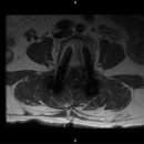 바른몸한방병원 이미지