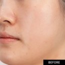 내돈내산 가인미가 안면비대칭경락 분당 성남경락20회 솔직후기