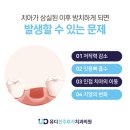 유디전주효자치과의원 | 전주치과 식립 후 변화 알아보며