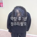 서울나래학교 | [30대 유방암] 마지막 항암 후 15개월, 대구 붙임머리 나래헤어아트 내돈내산 찐후기