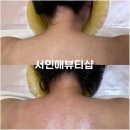 수성구에스테틱 대구 황금드레스라인케어 후기 서인애뷰티샵
