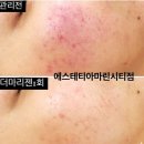 184 | 해운대피부관리 제대로 받고 싶다면 에스테티아 마린시티점 윤곽관리 후기