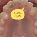 로미오치과교정과치과의원 네이버블로그