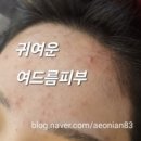 에스엔투 네이버블로그