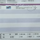 수정-48 | 인공수정 1차 시술후기(난포주사 후 48시간)