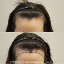 수정헤어디자인 이미지