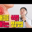 목에 낀 가래 없애기 가래 없애는 방법과 생기는 이유 이미지