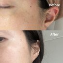 씨유 서영더엘점 | 검단원당동 피부관리 :: <비비드엘> 인천점, 출산 후 기미 잡티 고민 해결한 미백관리 후기