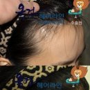 옥건헤어라인의원 이미지