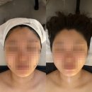 담에스테틱3 | [세종] 윤곽관리 맛집 수예담에스테틱 비대칭 관리 후기(웨딩관리 추천)
