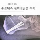 평발 모양에 따라 주의해야 하는 점들! 이미지