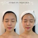 논현동피부관리 엘루엔에스테틱 강남본점 위치.가격.시간.후기