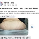 남친 뭐지 갑자기 지 뱃살 사진 보냈어(혐주의) 이미지