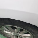 천안외형복원스피드덴트