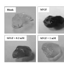 Re: betaine(trimethylglycine, TMG)의 항암효과 기전 이미지