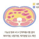 투비