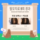 부산학문의원 | 울산 탈모성지 이름 뒤에 숨겨진 진실