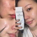 이지이샵 | 피부과 시술 후 관리템 엘라스티 포스트랩 재생크림 추천