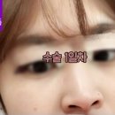 비씨아이성형외과의원 이미지