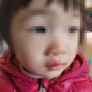 시은치과의원 네이버블로그