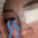 수지로 | 다래끼수술 / 리얼 후기..🚫절대 하지 마셔요🚫수지구청 안과