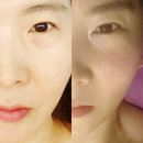 장수명가 | 신경성 스트레스·두통·생리통 관리, 수기관리 전문 여왕명가 재방문 후기