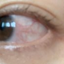 마곡성모안과의원 이미지