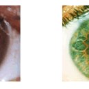 잠실서울밝은안과의원 이미지