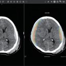 제이엘케이(JLK) 이미지