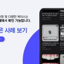 치아세상치과 네이버블로그