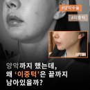 보람외과의원 | 이중턱 리프팅 효과 없었다면? 턱선 정리하는 구조 리프팅 후기 – 다움성형외과 김대현 원장