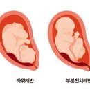 전치 앞(2) 이미지