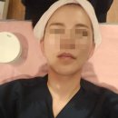 더블유(W)서울치과의원 | 강남 W클리닉 볼뉴머 리프팅 시술 솔직 후기