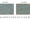 피부곱다
