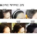 김헤어라인 이미지