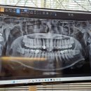 연세굿바이사랑니치과의원 이미지