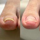 삼정동물병원 | 부산 내성발톱 관리 패디당 수술 대신 재발 방지 방법