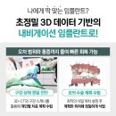 예치과의원 | 임플란트 안전하게 식립하고 오래 사용하기 위한 조건 [이천예치과]